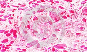 Bacteria under the microscope background.  background  bacteria