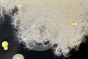 Bacteria, yeast and mold on a petri plate