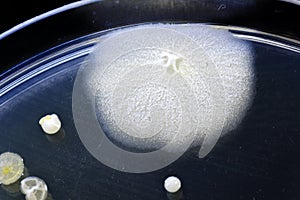 Bacteria, yeast and mold on a petri plate