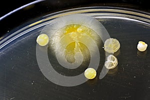 Bacteria, yeast and mold on a petri plate