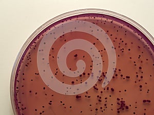 Bacterial colonies photo