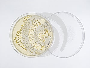 Bacteriano colonia sobre el lámina 