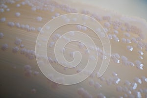 Bacterial Colonies on Agar Plate