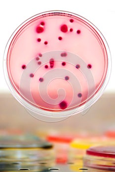 Bacterial colonies culture