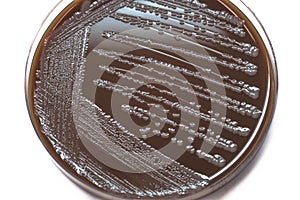 Bacterial colonies culture on Chocolate agar(CA agar)