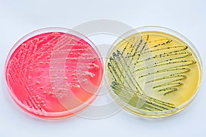Bacterial colonies culture on Differential and Selective media