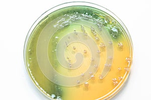 Bacterial colonies culture growth on MacConkey agar.
