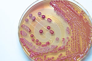Bacterial colonies culture growth on MacConkey agar (MAC agar). photo
