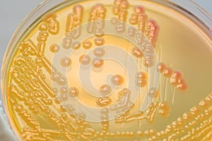 Bacterial colonies culture on MacConkey agar media.