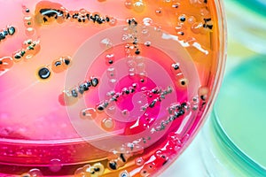 Bacterial colonies culture on selective agar media(SS agar).