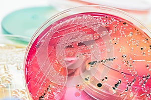 Bacterial colonies culture on selective agar media(SS agar)