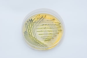 Bacterial colonies culture on selective agar media XLT Agar (Xy