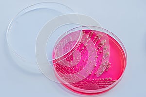 Bacterial colonies culture on selective agar media XLT Agar (Xy