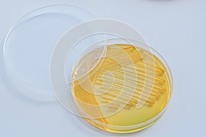 Bacterial colonies culture on selective agar media XLT Agar (Xy