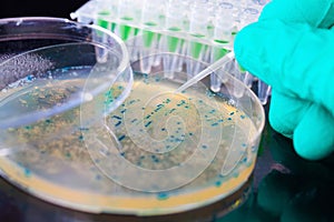 Bacterial colony in petri dishes photo