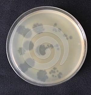 Bacterial colony with spots caused by bacteriophage