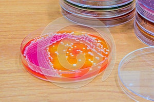 Bacterial culture growth on agar plate.