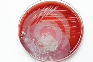 Bacterial culture growth on Blood agar (contaminate pathogen).