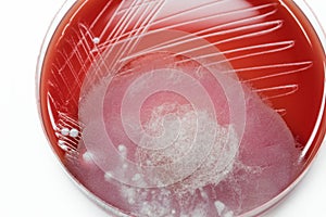 Bacterial culture growth on Blood agar (contaminate pathogen).