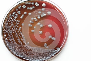 Bacterial culture growth on Blood agar (Gram negative bacilli)