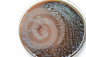 Bacterial culture growth on chocolate agar (gram positive bacilli).