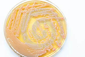 Bacterial culture growth on MacConkey agar (Gram Negative Bacilli).