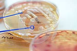 Bacterial culture growth on MacConkey agar (Gram Negative Bacilli)contains small light grains. Focus on all agar surface.