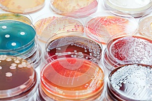 Bacterial culture growth on selective media.