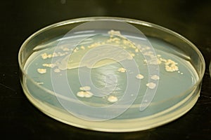 Bacterial culture on a petri plate
