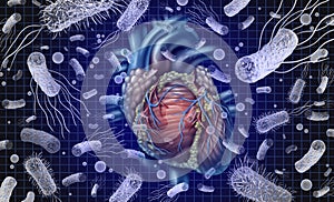 Bacterial Endocarditis