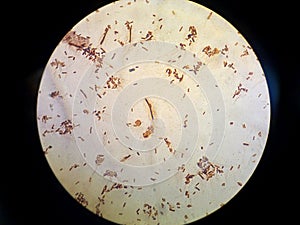 Bacterial flagellum e.coli photo