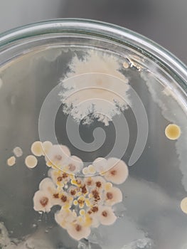 Bacterial and fungal colonies on saboraud dextrose agar medium