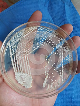 Bacterial growth