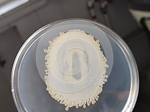 A bacterial growth in a petri plate dish with nutrient agar medium