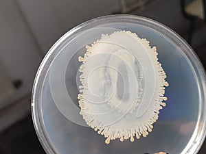 A bacterial growth in a petri plate dish with nutrient agar medium