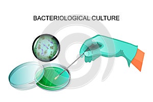 Bacterial inoculation in the laboratory photo