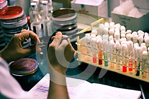 Bacterial Inoculation on a test tube agar culture media using inoculation loop by scientist lab technician in a microbiology labor