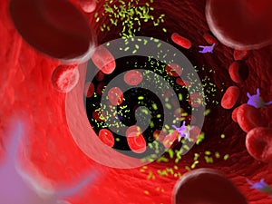 Bacterias in an artery