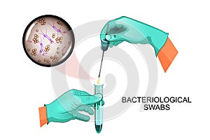 Bacteriological swabs