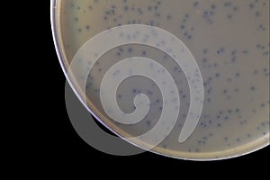 Bacteriophage plaques clear zone within the lawn bacterial aga