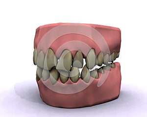 Malo higiene dientes 