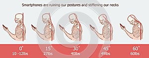 The bad smartphone postures,the angle of bending head related to the pressure on the spine, vector flat cartoon illustration. Man