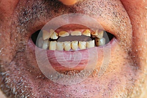 Bad teeth, close img