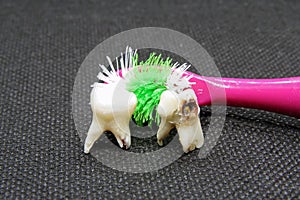 Bad tooth and toothbrush. Dental hygiene.Rotten tooth and toothbrush. Extracted tooth.