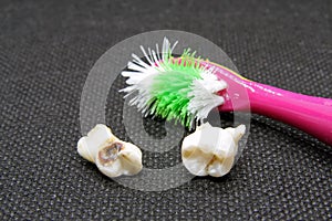 Bad tooth and toothbrush. Dental hygiene.Rotten tooth and toothbrush. Extracted tooth.