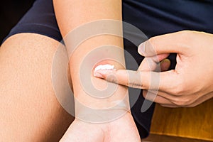 Baking soda being used to relieve itching from insect bites. photo