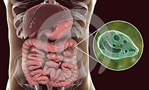 Balantidium coli protozoan in large intestine