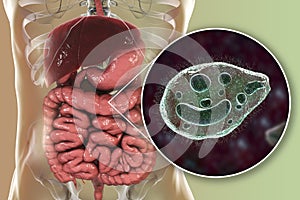 Balantidium coli protozoan in large intestine