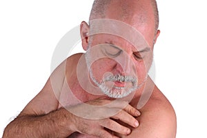 bald adult man showing shoulder skin irritation ringworm dermatological disease