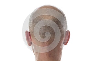 Bald man head on the back